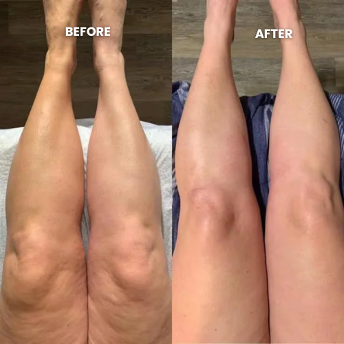 Lymphatic Drainage Wellness Drops