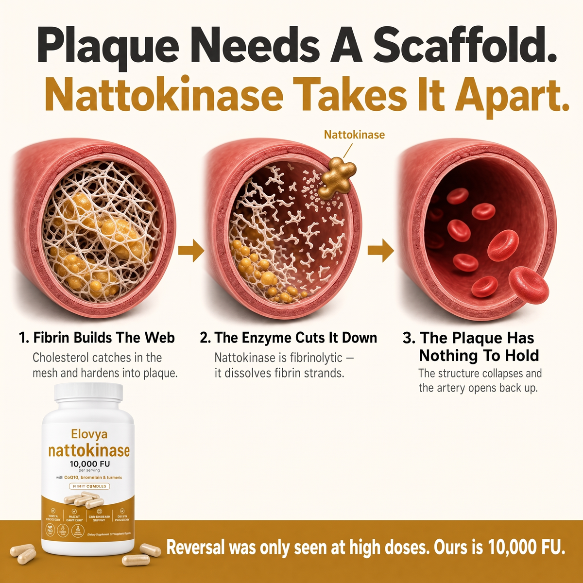 Nattokinase breaks down the fibrin scaffold