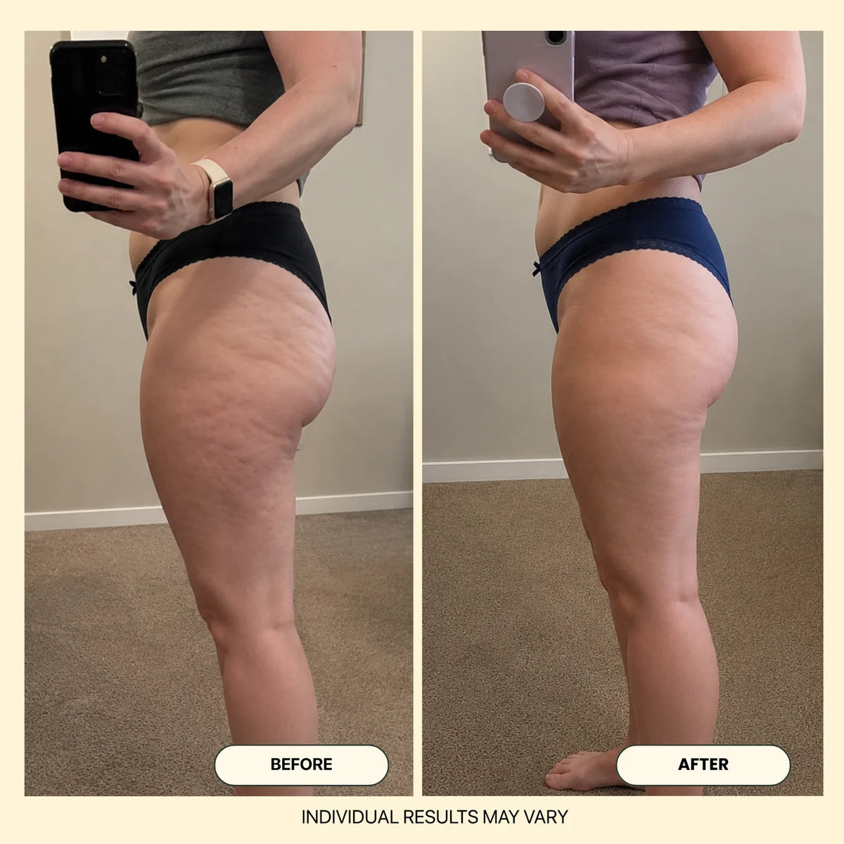 Elovya Anti-Cellulite Massage Oil