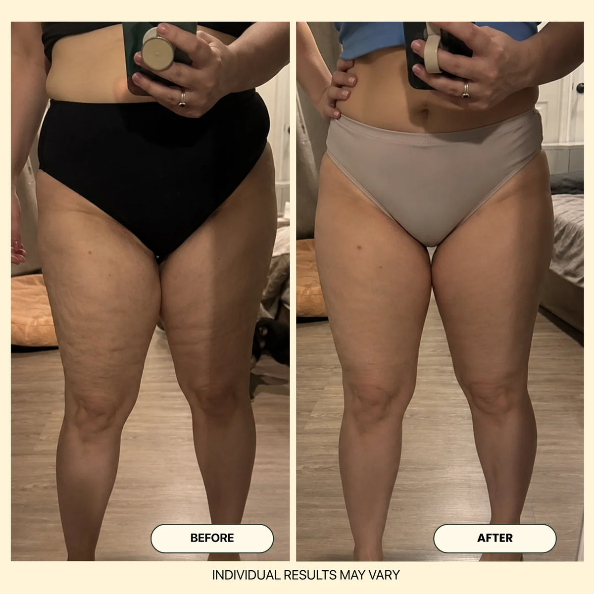 Elovya Anti-Cellulite Massage Oil