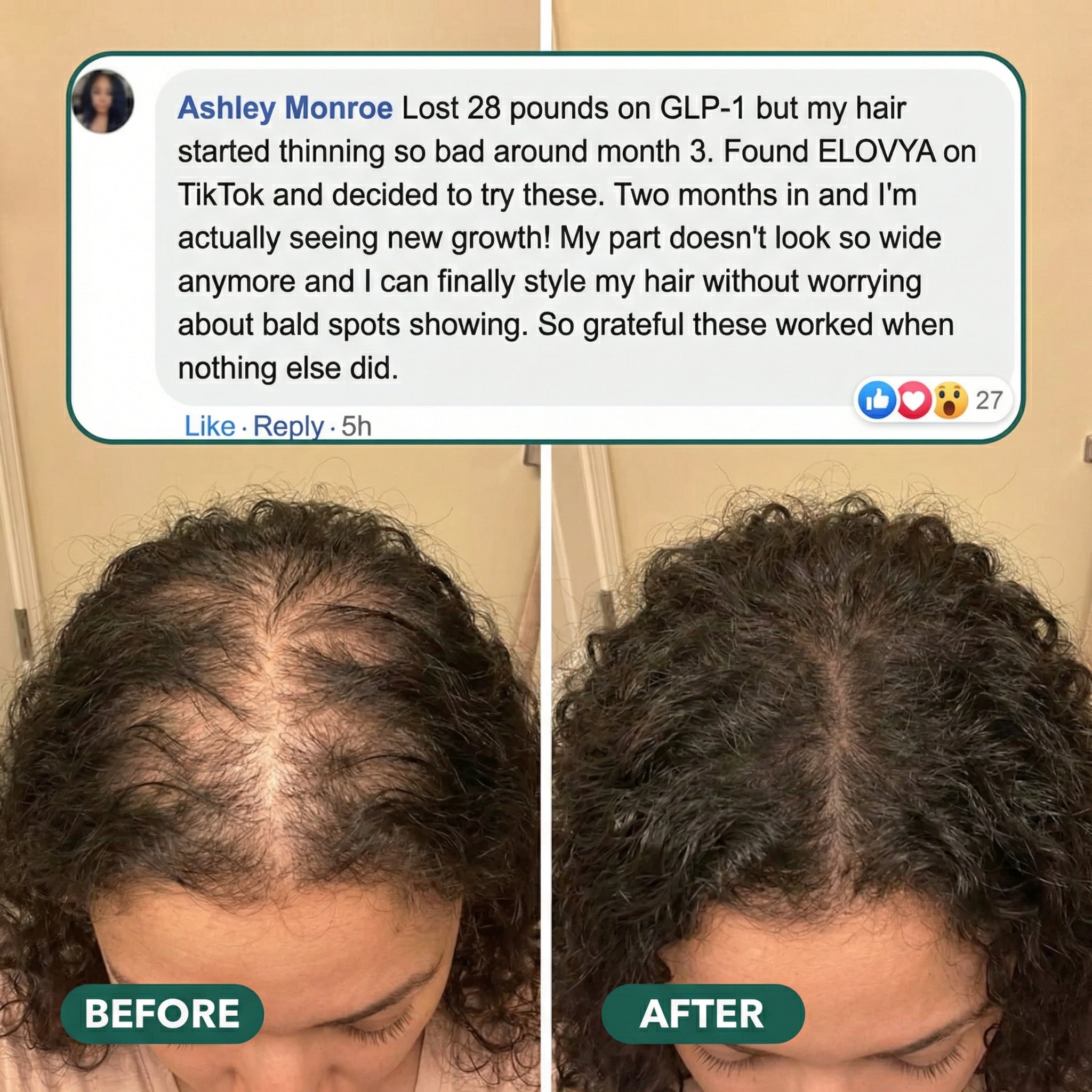 Hair Regrowth Gummies